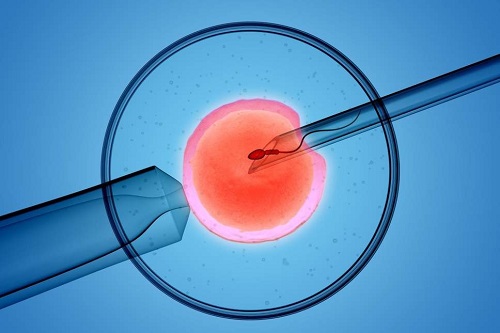 Thụ tinh trong ống nghiệm (IVF)